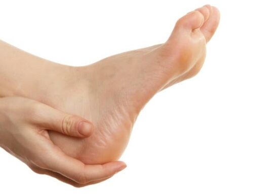 Ultimate Guide To Plantar Fasciitis