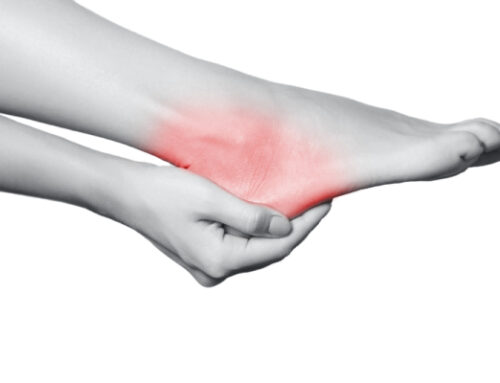 When Should I Be Concerned About Heel Pain?