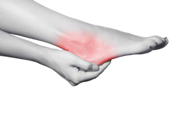 Plantar Fasciopathy: Tips to Relieve Heel Pain